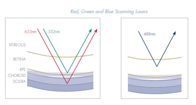 Graph of Red, Green, and Blue Scanning Lasers