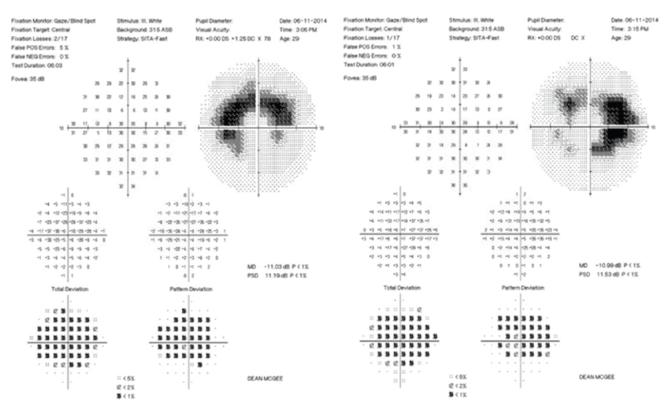 Eye chart