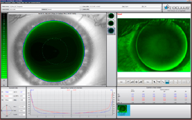 Fluorescein Imaging