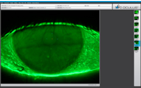 Fluorescein Imaging